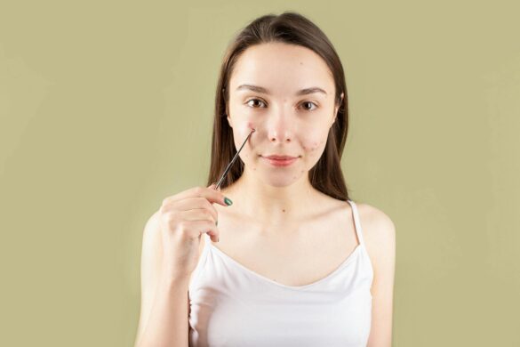 redness of pimples